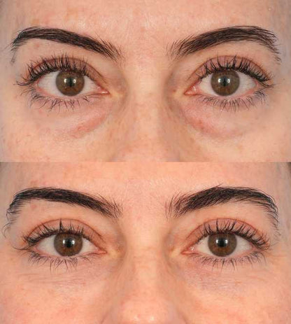 Sérum contour des yeux à l'huile de ricin – Soin cernes et poches