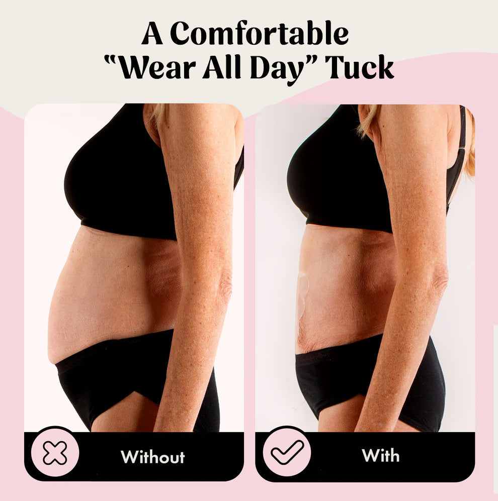Élevare™ Skin Tape