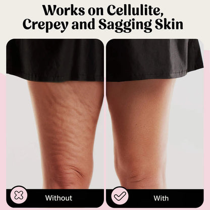 Élevare™ Skin Tape