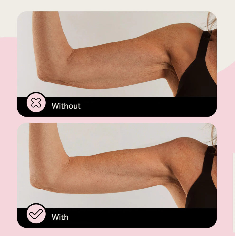 Élevare™ Skin Tape