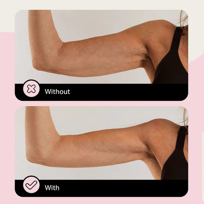 Élevare™ Skin Tape