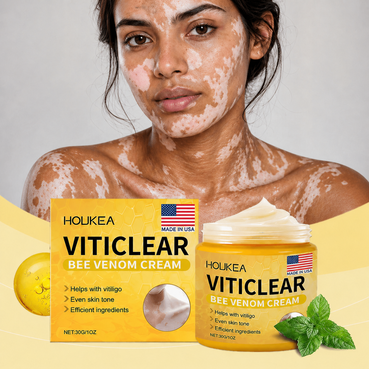 Crème pour la peau Vitiligo – Soin Restaurateur et Unifiant