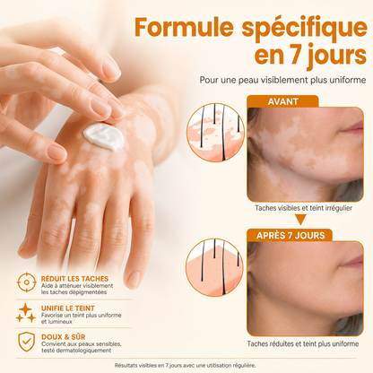 Crème pour la peau Vitiligo – Soin Restaurateur et Unifiant