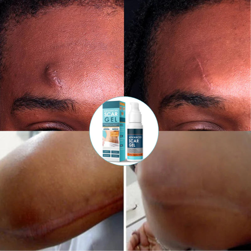 ScarFix™ Anti-Scar Repair Gel