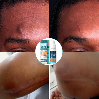 ScarFix™ Anti-Scar Repair Gel