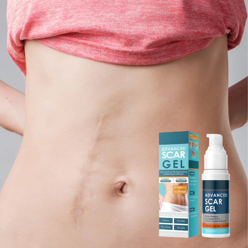 ScarFix™ Anti-Scar Repair Gel